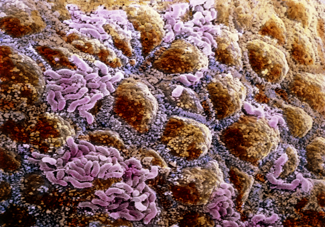 Micrografía de electrones que muestra parte del microbioma en el colon