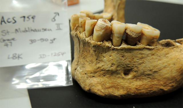 Dentadura y placa dental antigua