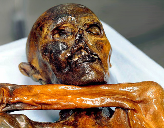 La momia Ötzi