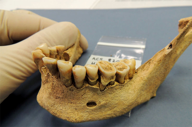 placa dental prehistorica