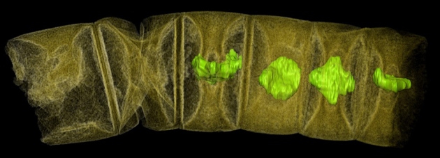 Preservación tridimensional de un organismo pluricelular de hace 1600 millones de años Preservación tridimensional de un organismo pluricelular de hace 1600 millones de años