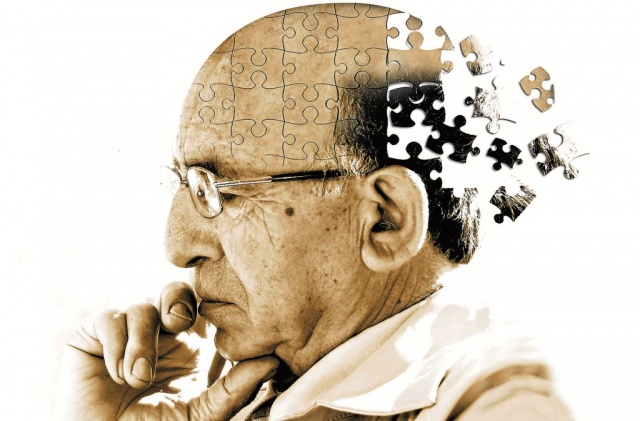 El Alzheimer afecta a más de 50 millones de personas en el mundo El Alzheimer afecta a más de 50 millones de personas en el mundo