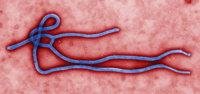 Micrografía electrónica colorizada del virión del ébola Micrografía electrónica colorizada del virión del ébola