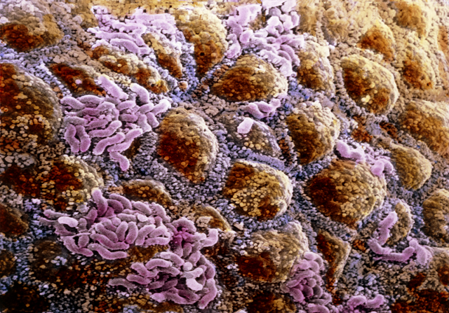 Micrografía de electrones que muestra parte del microbioma en el colon Micrografía de electrones que muestra parte del microbioma en el colon