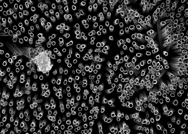 Nanotubos de titanio tratados con flúor proveyeron la mejor superficie Nanotubos de titanio tratados con flúor proveyeron la mejor superficie
