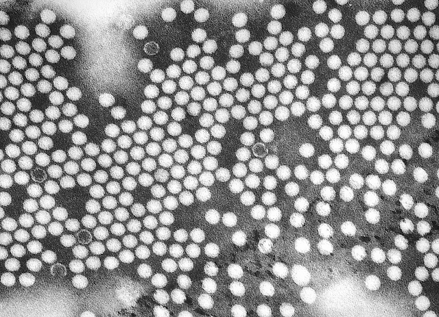Poliovirus