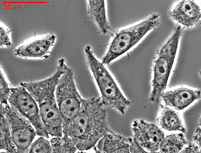 Cultivo celular HeLa