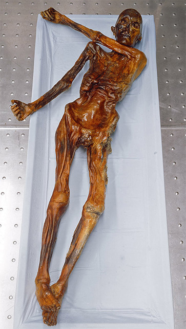 Otzi la momia